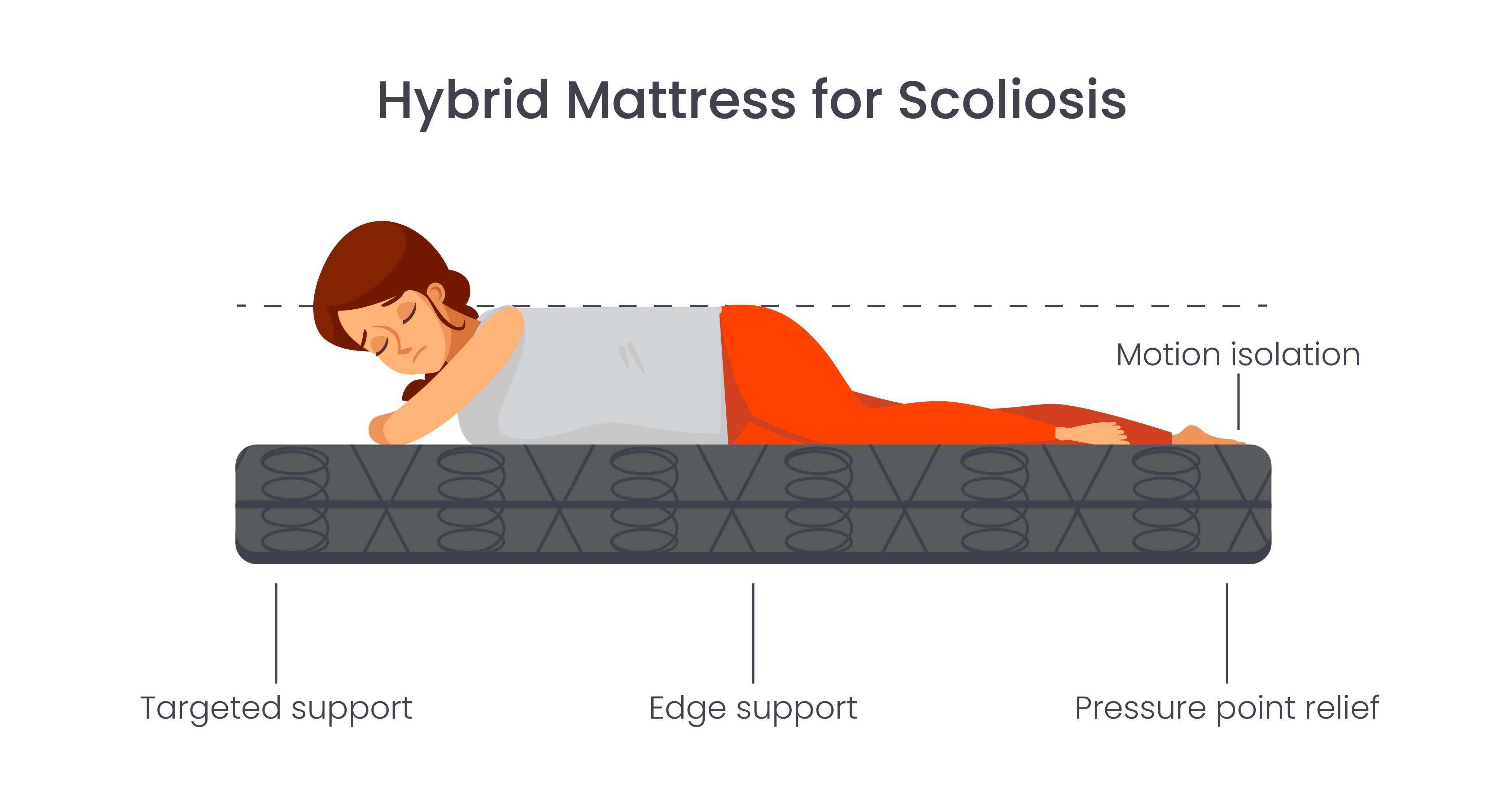 Hybrid mattress for scoliosis